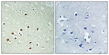 ERK 8 (phospho Thr175/Y177) rabbit pAb Antibody