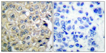 FGFR-3 rabbit pAb Antibody