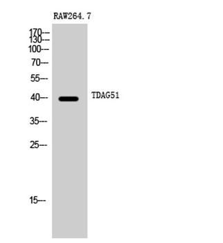 TDAG51 rabbit pAb Antibody