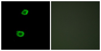 KPI-2 rabbit pAb Antibody