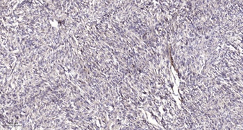 Intestinal Cell Kinase (phospho Tyr159) rabbit pAb Antibody