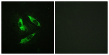 Rabphilin-3A (phospho Ser237) rabbit pAb Antibody