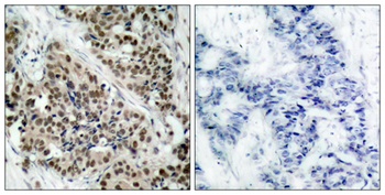 FoxO1 (phospho Ser256) rabbit pAb Antibody