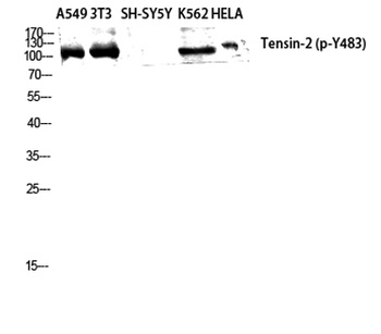 Tensin-2 (phospho Tyr483) rabbit pAb Antibody
