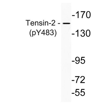 Tensin-2 (phospho Tyr483) rabbit pAb Antibody
