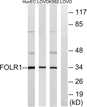 FR-α rabbit pAb Antibody