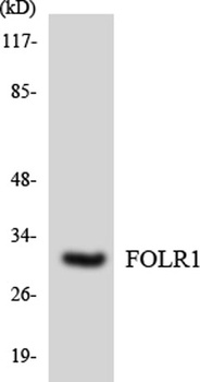 FR-α rabbit pAb Antibody