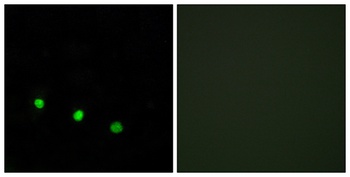 Fos B (phospho Ser27) rabbit pAb Antibody