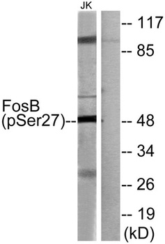 Fos B (phospho Ser27) rabbit pAb Antibody