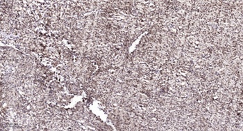 Fos B (phospho Ser27) rabbit pAb Antibody