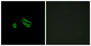 FPRL2 rabbit pAb Antibody