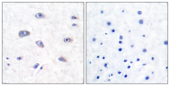 BACE rabbit pAb Antibody