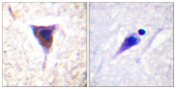 mTOR (phospho Ser2481) rabbit pAb Antibody
