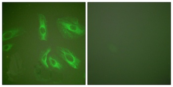 Gastrin rabbit pAb Antibody