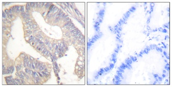 Gastrin rabbit pAb Antibody