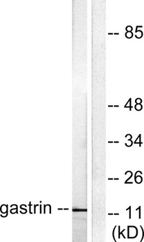 Gastrin rabbit pAb Antibody