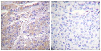 Gab 1 (phospho Tyr659) rabbit pAb Antibody