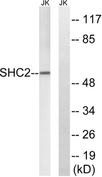 Sck rabbit pAb Antibody