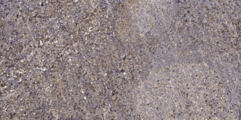 Sck rabbit pAb Antibody