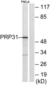 PRPF31 rabbit pAb Antibody