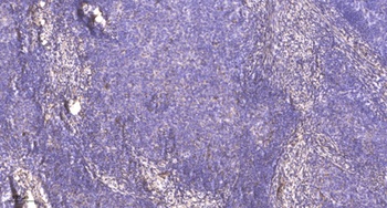 PRPF31 rabbit pAb Antibody