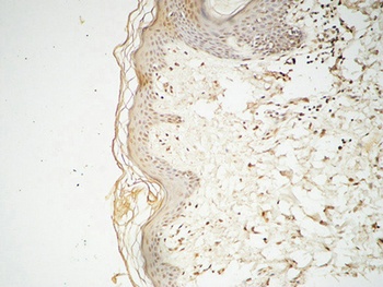 GATA-2/3 rabbit pAb Antibody