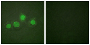 GATA-4 (phospho Ser262) rabbit pAb Antibody