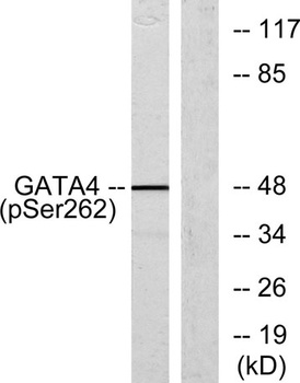 GATA-4 (phospho Ser262) rabbit pAb Antibody