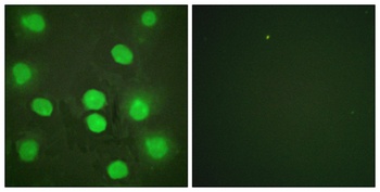 GATA-4 rabbit pAb Antibody