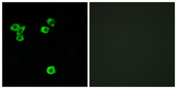 p52 S6 kinase rabbit pAb Antibody