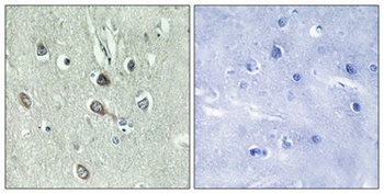 HBP1 (phospho Ser402) rabbit pAb Antibody