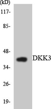 Dkk-3 rabbit pAb Antibody