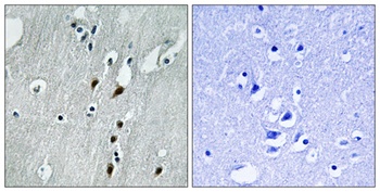 Pdcd-4 (phospho Ser457) rabbit pAb Antibody