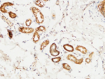 14-3-3 σ rabbit pAb Antibody
