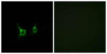 GPR43 rabbit pAb Antibody