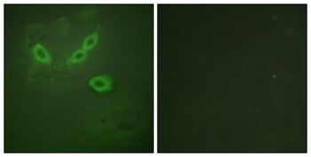 LOST1 rabbit pAb Antibody