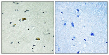 GRB10 (phospho Tyr67) rabbit pAb Antibody