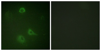 NMDAζ1 (phospho Ser890) rabbit pAb Antibody