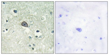 NMDAζ1 (phospho Ser890) rabbit pAb Antibody