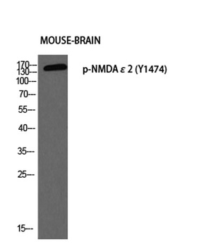 NMDAε2 (phospho Tyr1474) rabbit pAb Antibody