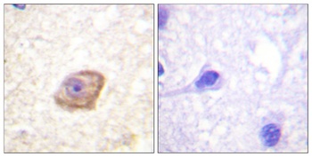NMDAε2 (phospho Tyr1474) rabbit pAb Antibody