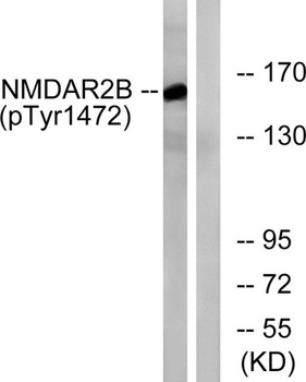 NMDAε2 (phospho Tyr1474) rabbit pAb Antibody