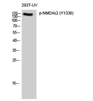 NMDAε2 (phospho Tyr1336) rabbit pAb Antibody