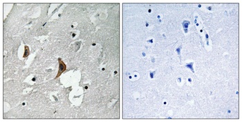 NMDAε2 (phospho Tyr1336) rabbit pAb Antibody