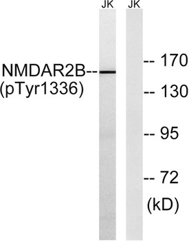 NMDAε2 (phospho Tyr1336) rabbit pAb Antibody