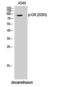 GR (phospho Ser203) rabbit pAb Antibody