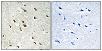 GRF-1 (phospho Tyr1105) rabbit pAb Antibody