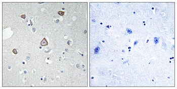 mGluR2 rabbit pAb Antibody
