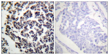 BLNK (phospho Tyr96) rabbit pAb Antibody