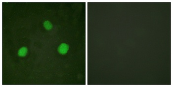 Histone H3.3 (phospho Ser31) rabbit pAb Antibody